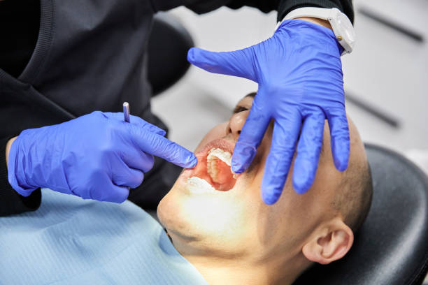 Best Emergency Dental Care for Broken or Chipped Teeth in Waterford, CA